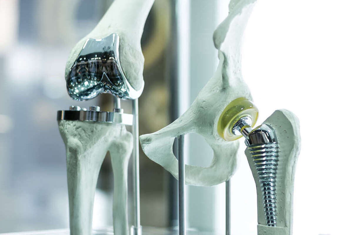 Российскими учёными разработан инновационный биоразлагаемый сплав для костных имплантов